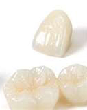 ceramic_crowns
