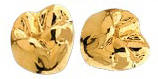 gold_dental_crown